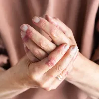 首や顔がかゆい…その赤みやブツブツ、もしかしてアトピー?原因・対策を徹底解説!