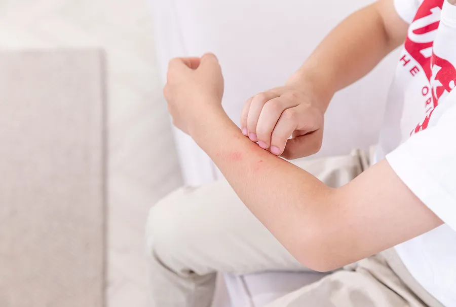 皮膚発疹の原因