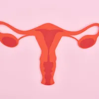 「多嚢胞性卵巣症候群」の症状や原因、治療法を解説