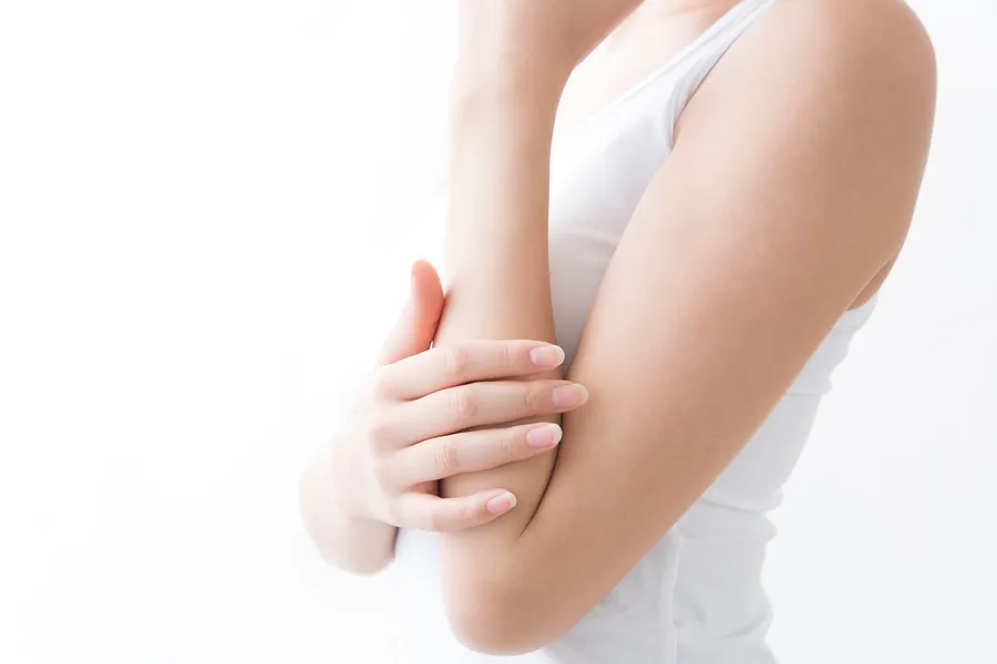 粉瘤は表皮嚢腫とも呼ばれています。