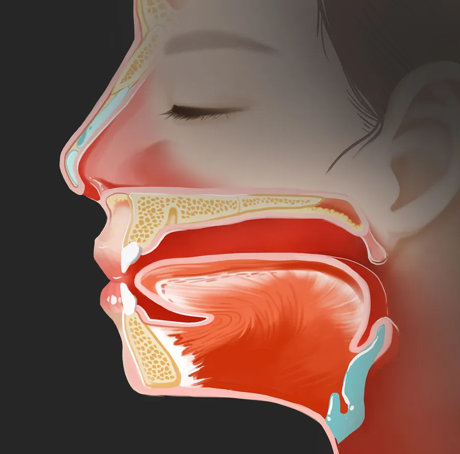 上咽頭がんの症状
