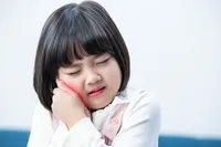 おたふく風邪(耳下腺炎)の症状や原因、治療法を徹底解説