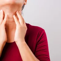 「菊池病」知っていますか?菊池病の症状や原因、治療法について