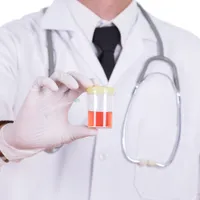 「血が混じった尿が出ます。」血尿の症状、原因、治療法まとめ