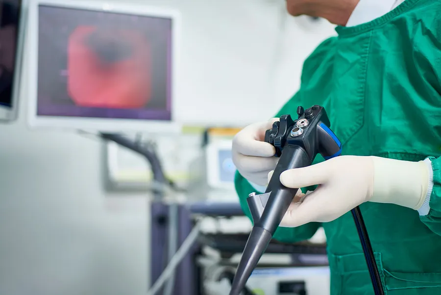 大腸ポリープ除去