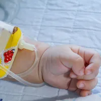 新生児黄疸、なぜ起こるのでしょうか?新生児黄疸の原因、症状、治療法について