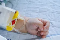 新生児黄疸、なぜ起こるのでしょうか?新生児黄疸の原因、症状、治療法について