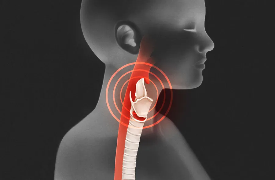 喉頭癌の初期症状