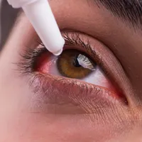 「急に目が充血してきた?!」目が充血する原因と疑われる疾患4つ