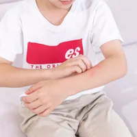 夏にかかりやすい『乳幼児の膿痂疹(とびひ)』原因や感染性、症状、治療法について