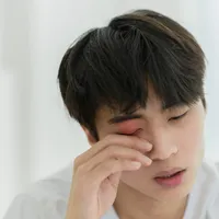 突然まぶたが腫れた?眼瞼炎かもしれません。治療法と原因、症状について