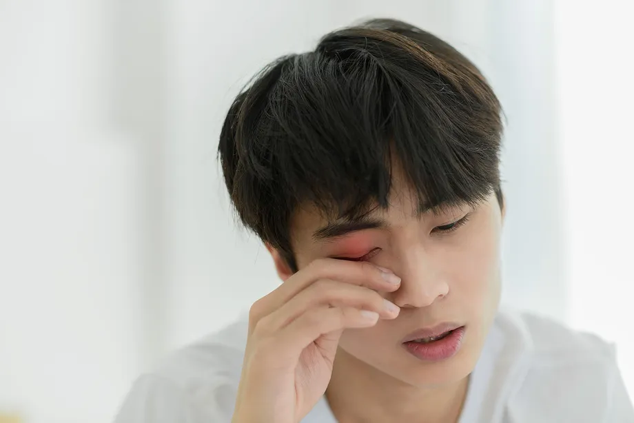 突然まぶたが腫れた?眼瞼炎かもしれません。治療法と原因、症状について