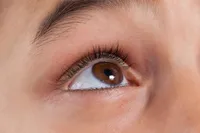 まつげが目を刺す眼瞼内反、原因は何でしょうか?