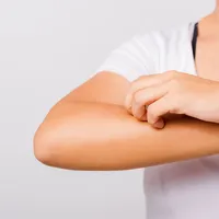 「皮膚描記症は治療可能ですか?」皮膚描記症の症状、原因、治療法について