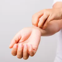 皮膚のかゆみや赤みがある?それは「接触性皮膚炎」の可能性があります。