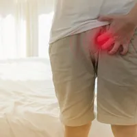 生殖器にできるイボ「尖圭コンジローマ」の症状と原因、治療法、検査方法について解説します