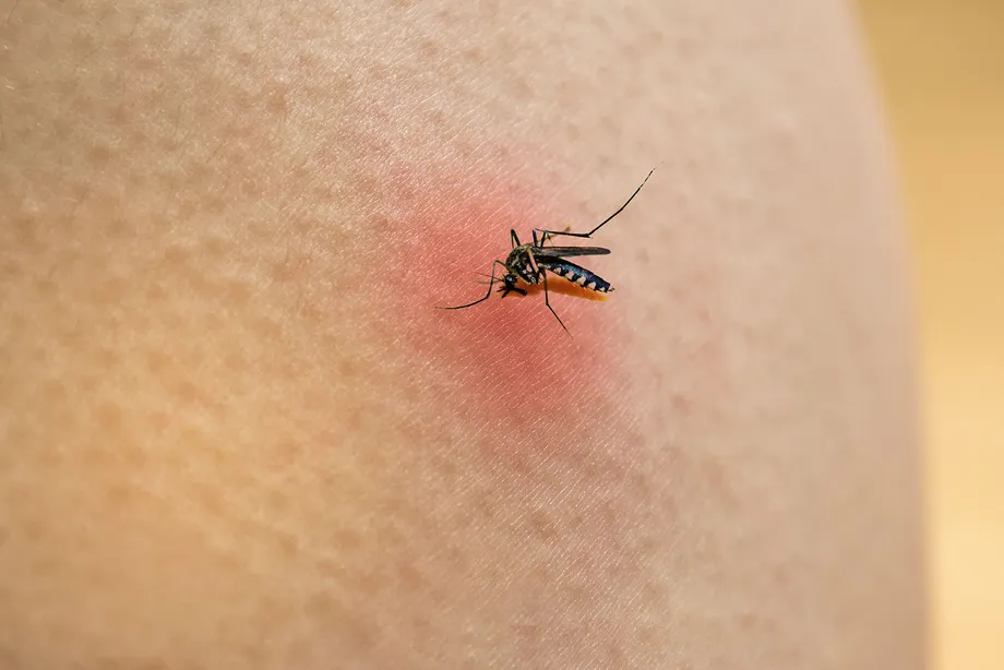 「マラリア」症状、蚊、予防薬、ワクチン、治療法について見てみましょう。