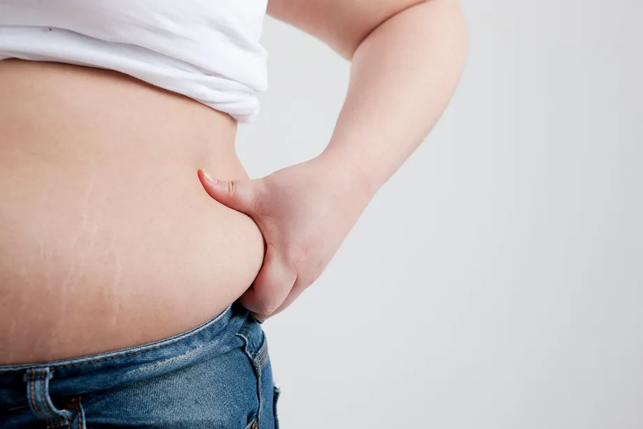 理由のない体重増加、「クッシング症候群」が原因かも?クッシング症候群の症状、原因、治療法