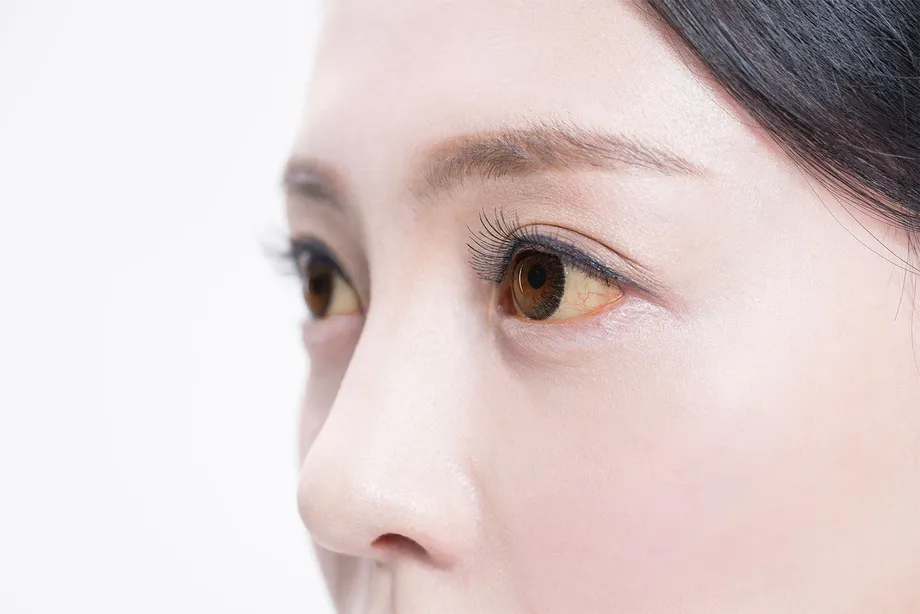 A型肝炎の予防接種や症状、感染、原因、ワクチン、治療法まとめ