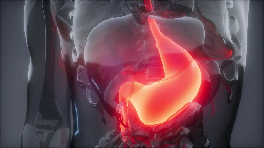 腸上皮化生の症状