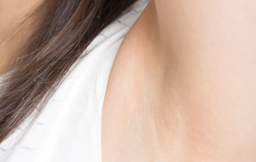 脇の下のしこり