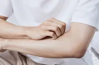 「ジベルばら色粃糠疹って何ですか?」皮膚の風邪と呼ばれるジベルばら色粃糠疹を解説