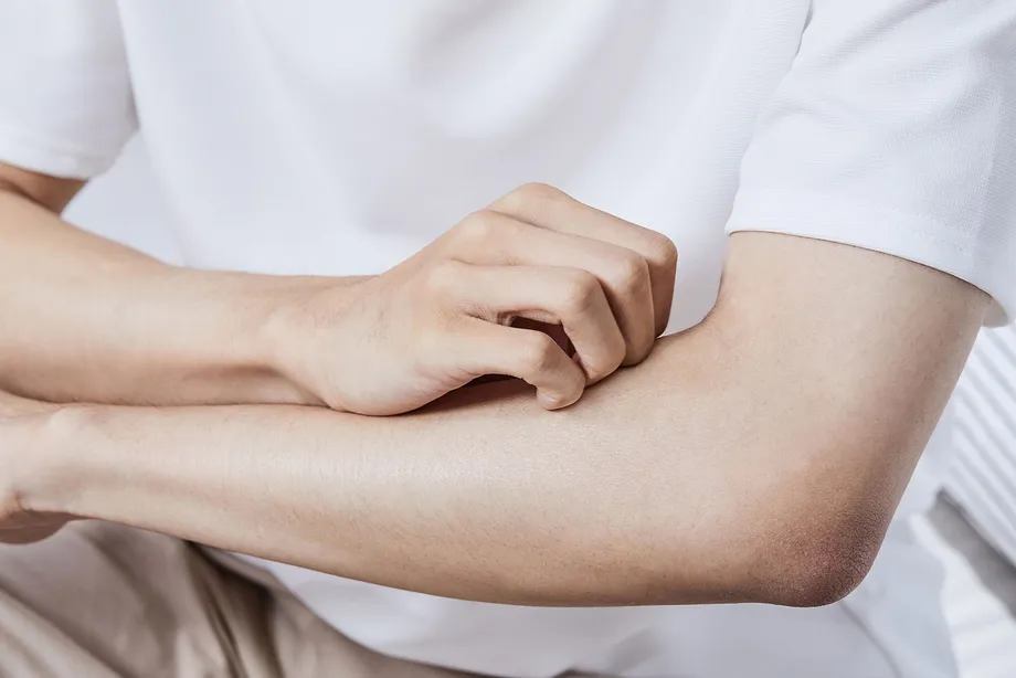 「ジベルばら色粃糠疹って何ですか?」皮膚の風邪と呼ばれるジベルばら色粃糠疹を解説