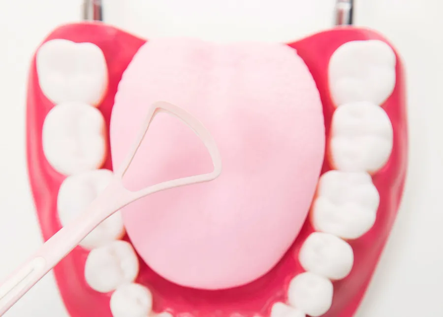 舌苔の除去方法