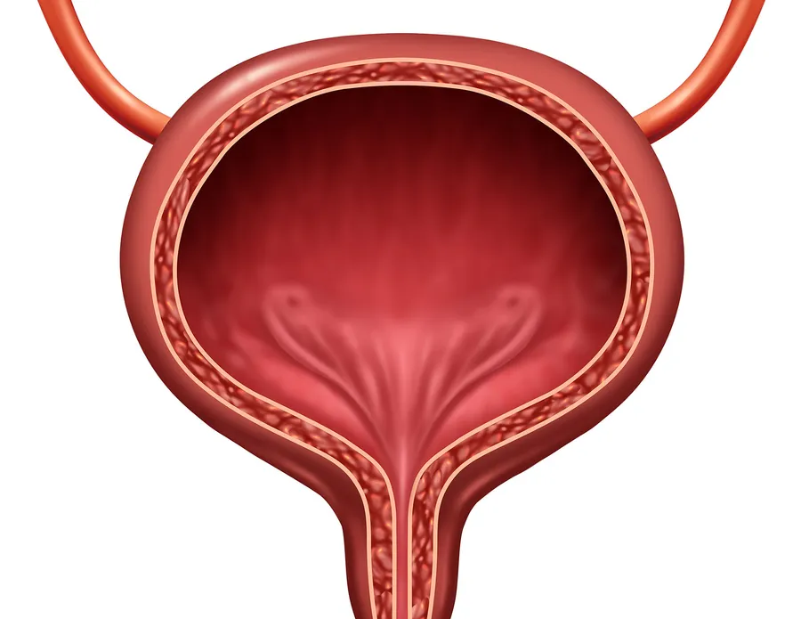 膀胱がんの症状