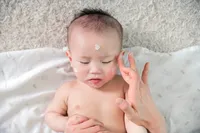 乳児のアトピー管理、5つの方法を試してみてください!