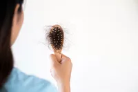 ハゲたくないならこれを食べて!髪の毛に良い食べ物5選