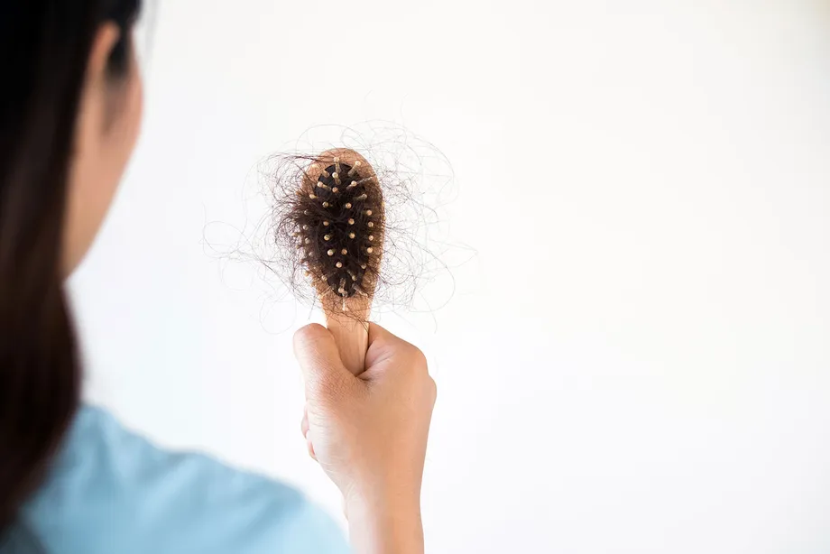 ハゲたくないならこれを食べて!髪の毛に良い食べ物5選