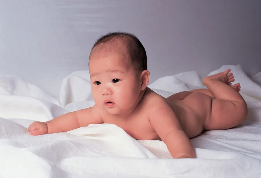 新生児斜頸の治療