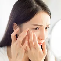 稗粒腫(目の周りのぶつぶつ)の原因はなに?取り除く方法とよくいただく質問について