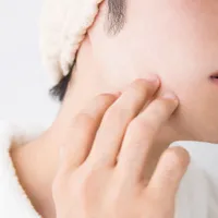 毛包炎の原因や治療法、ニキビとの違いを解説
