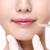 薄い唇がコンプレックス? 唇フィラーの効果、副作用、持続期間について