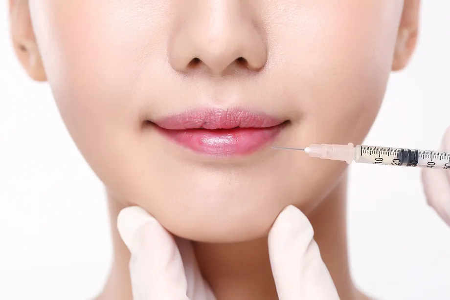 薄い唇がコンプレックス? 唇フィラーの効果、副作用、持続期間について
