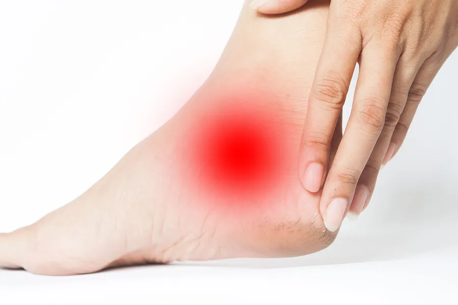 有痛性外脛骨の痛み