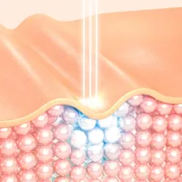「チューンフェイス効果が気になります」チュンフェイス効果、副作用、原理についてまとめました。