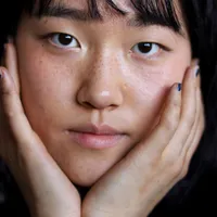 そばかすと肝斑の違いは?「そばかす」の除去法と発生する理由