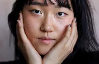 そばかすと肝斑の違いは?「そばかす」の除去法と発生する理由