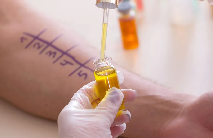 アレルギー検査