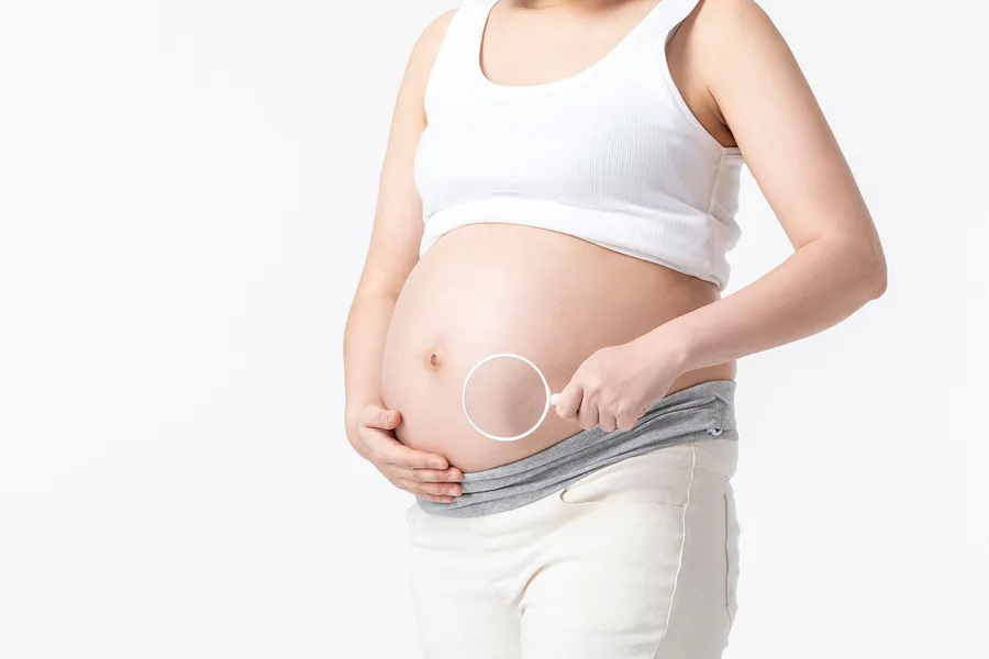 妊娠中毒症の治療