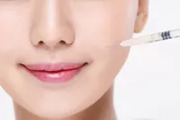 ほうれい線が気になるなら? スカルプトラの効果、原理、痛み、副作用について