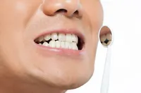 開咬の矯正、必要でしょうか? 開咬の原因や治療法について