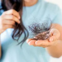 もしかしてハゲ?脱毛症の自己診断と、よくよせられる質問まとめ