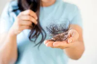 もしかしてハゲ?脱毛症の自己診断と、よくよせられる質問まとめ