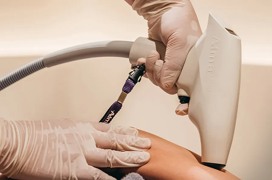 セルライトの治療