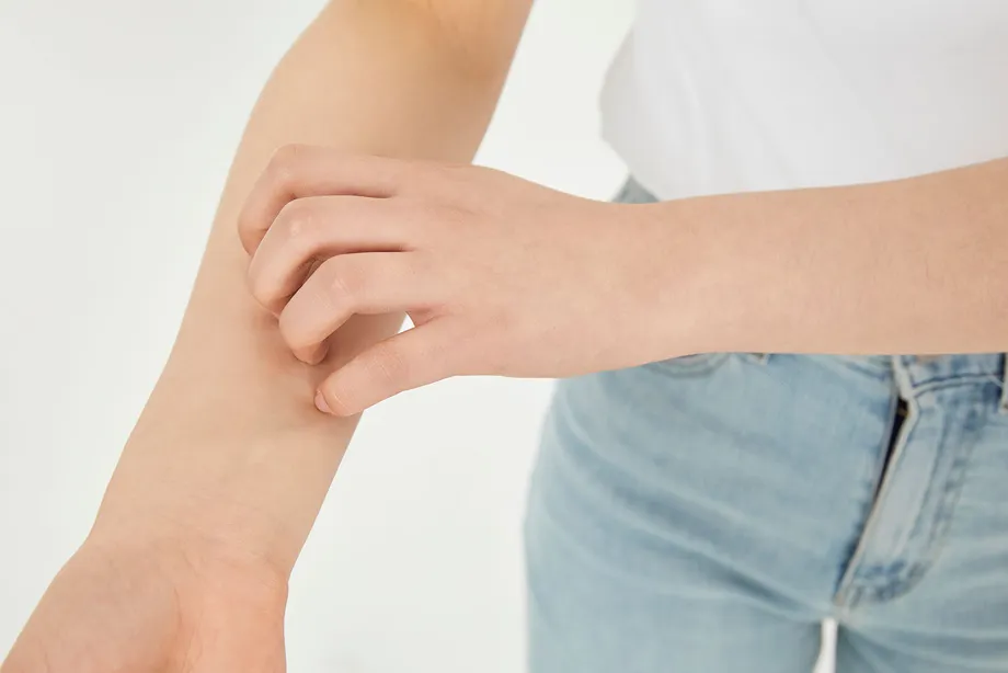 季節の変わり目にかゆみが増す「アトピー性皮膚炎」、治療法と原因