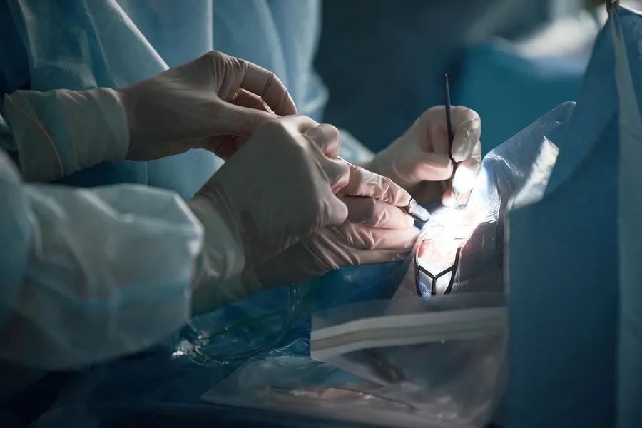 眼腫瘍の治療